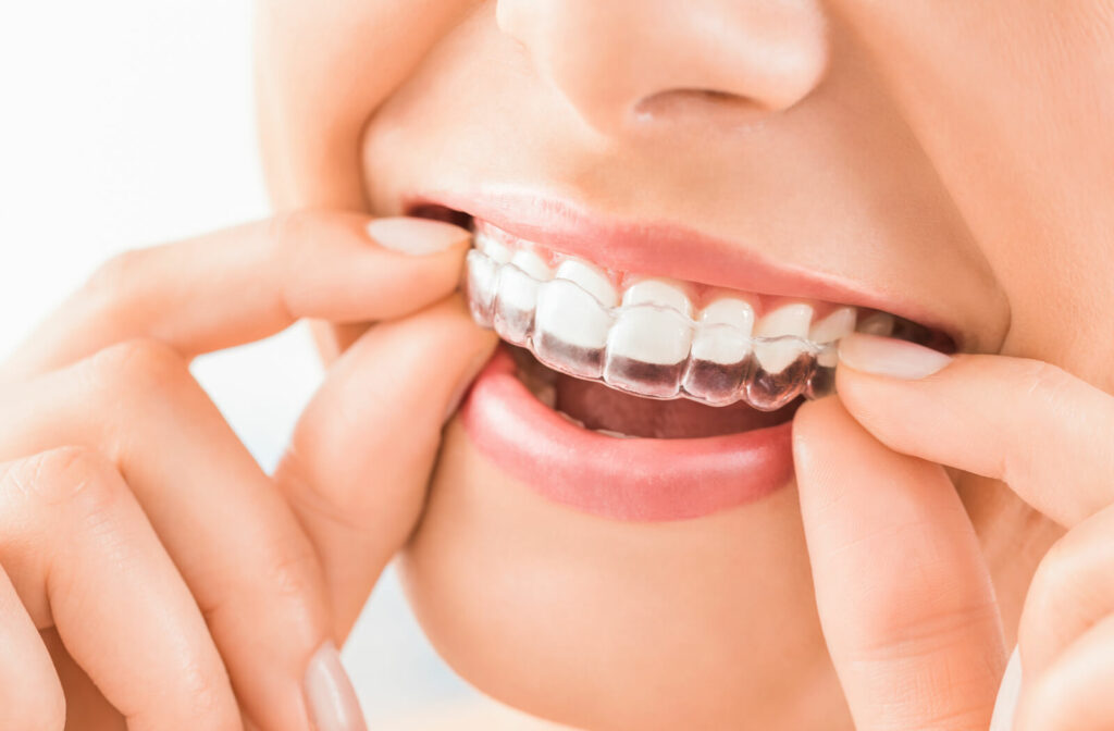 Close up image of a smiling woman putting on her Invisalign aligner.