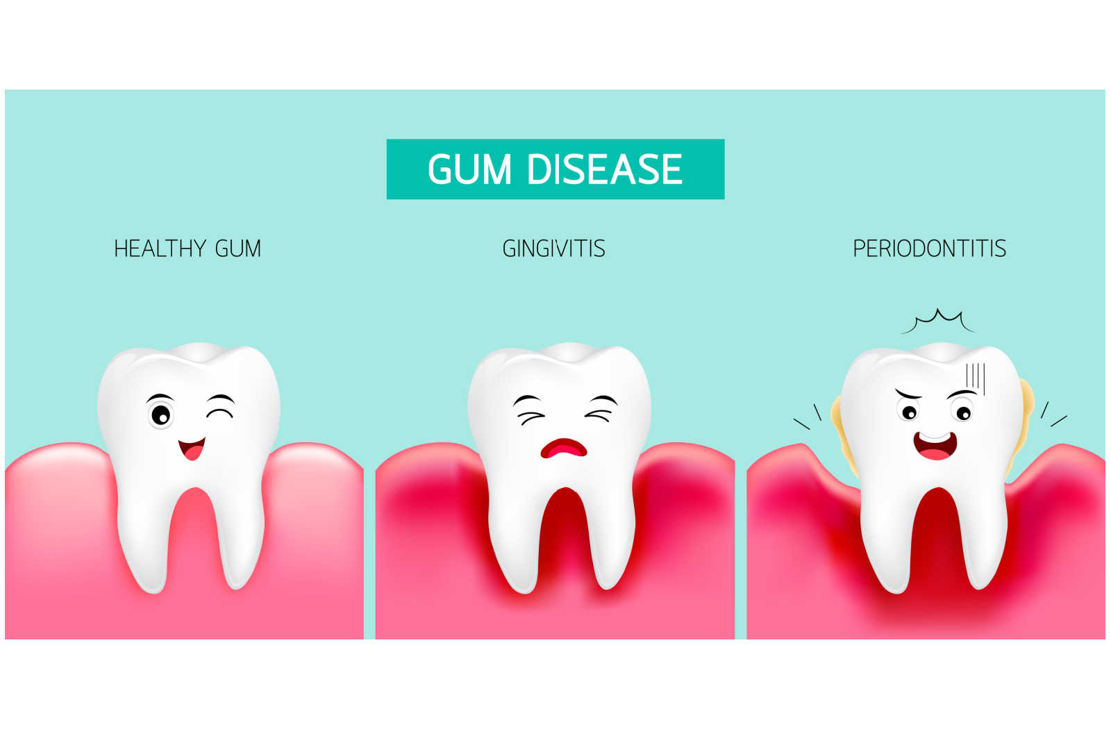 Is Gingivitis Reversible? | Symmetry Dental | Calgary
