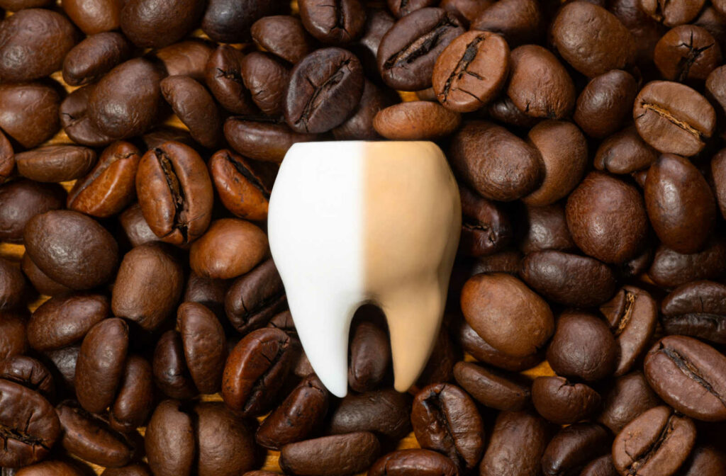A large-size model tooth with a stain and laying on a pile of coffee beans. Coffee can cause teeth discoloration.